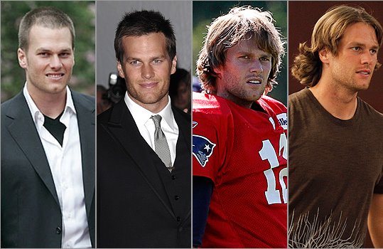 tom brady hair transplant before after
